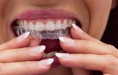 Ortodoncia invisible, qué es y ventajas