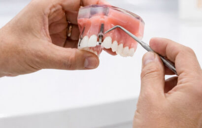 Implante dental