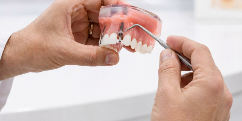 Implante dental